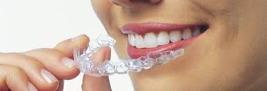 Nyt smil med Invisalign